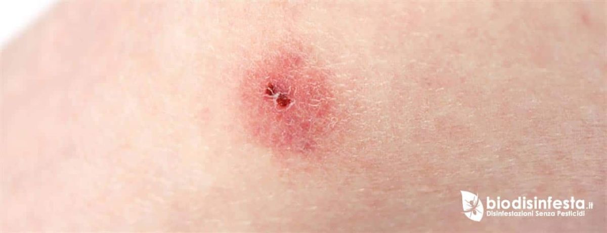 Disinfestazione zecche del piccione – Ascolto